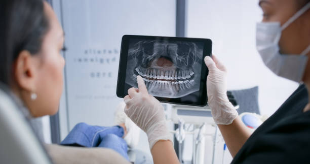 Licensed Wisdom Tooth Removal service in Brea, CA - Smile Center Dentistry